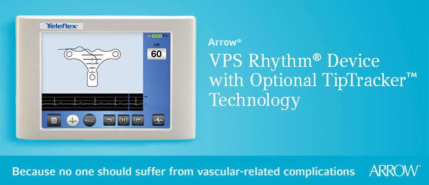 usa - vascular access - catheter tip positioning - vps - technology