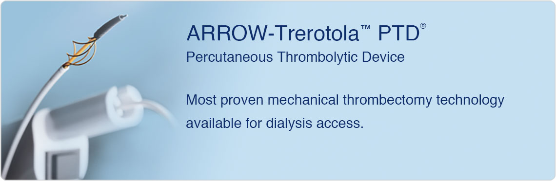 china - interventional access - ptd