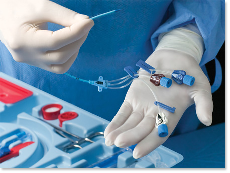 SECTION 3: CENTRAL VENOUS ACCESS DEVICE SELECTION