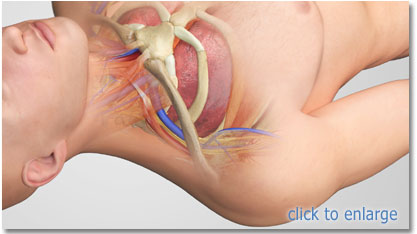 ij right position for ultrasound