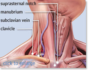 subclavian anatomy