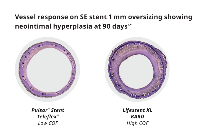 Pulsar-18 T3 Vessel Response