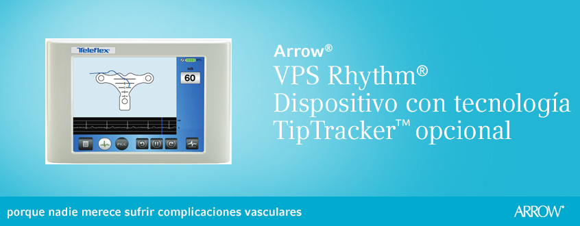 usa - vascular access - catheter tip positioning - vps - technology