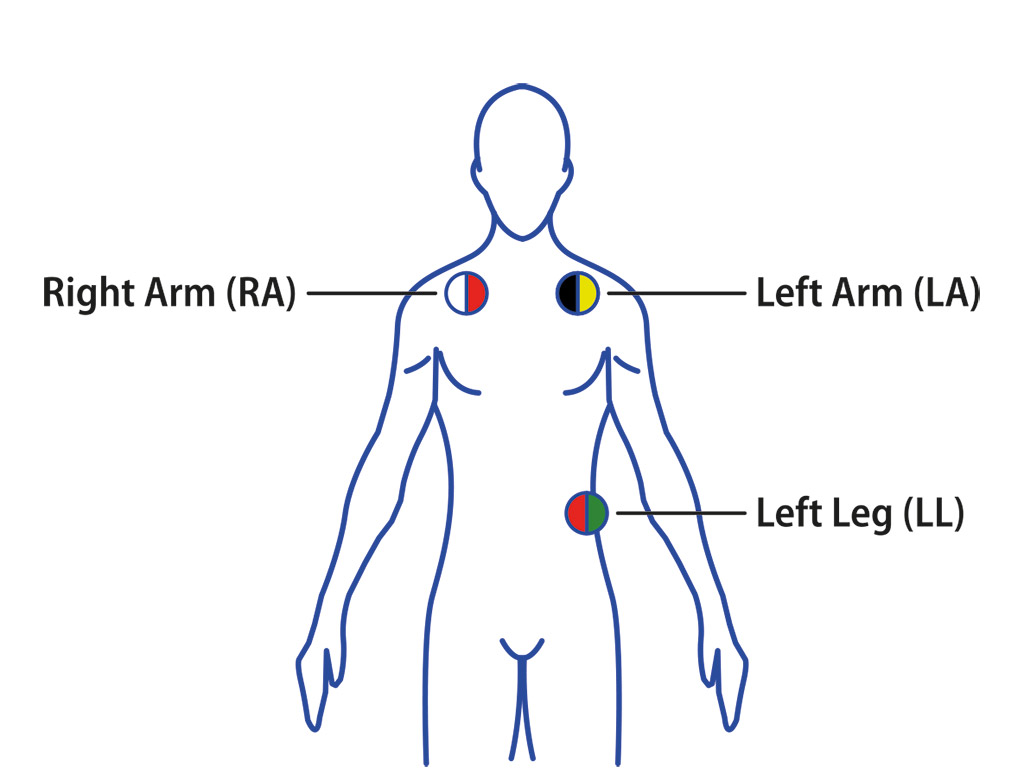 TS-BF-ECG_1-1-2_AHA-IEC