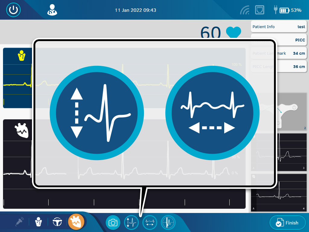 TS-BF-ECG_2-4-1_Scaling